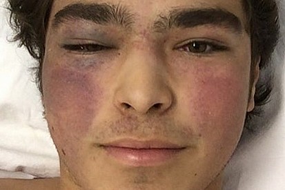 Pedro Piquet sigue internado en Goiania después de su accidente