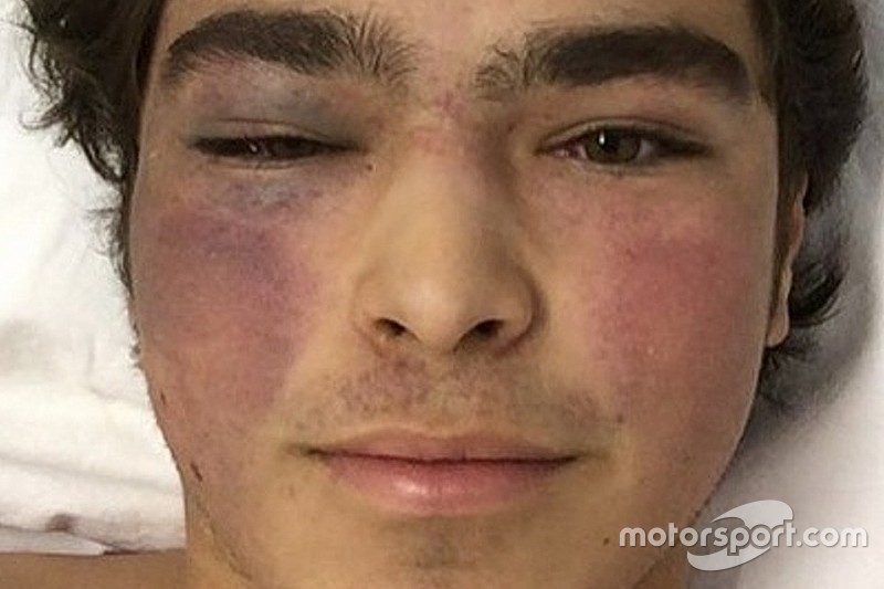 Pedro Piquet sigue internado en Goiania después de su accidente