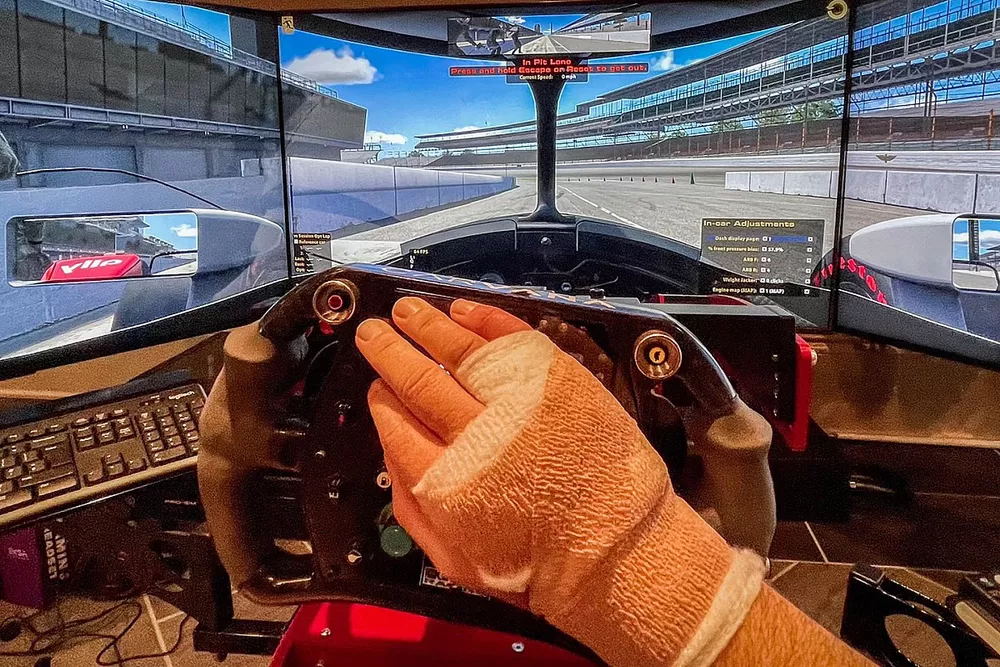 Jimmie Johnson's bandaged hand after surgery