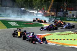 Fernando Alonso, McLaren MCL32 se bloquea en el inicio de la carrera